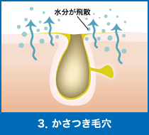 3．かさつき毛穴